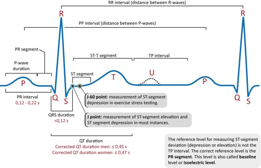Revolutionizing ECG Interpretation in Athletes: Expert Insights from Dr. Babette Pluim

—

Transforming How We Interpret Athletes’ ECGs: Breakthrough Insights from a Leading Expert