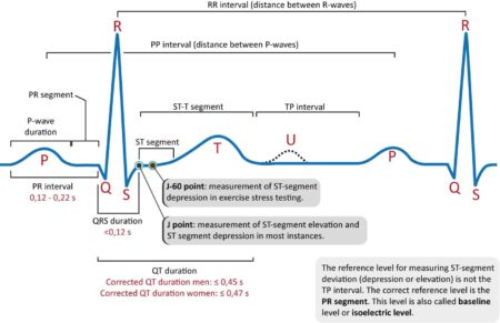 Revolutionizing ECG Interpretation in Athletes: Expert Insights from Dr. Babette Pluim
—
Transforming How We Interpret Athletes’ ECGs: Breakthrough Insights from a Leading Expert Revolutionizing ECG Interpretation in Athletes: Expert Insights from Dr. Babette Pluim
—
Transforming How We Interpret Athletes’ ECGs: Breakthrough Insights from a Leading Expert