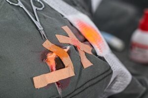 Rip Off the Old Band-Aid Once and For All!
